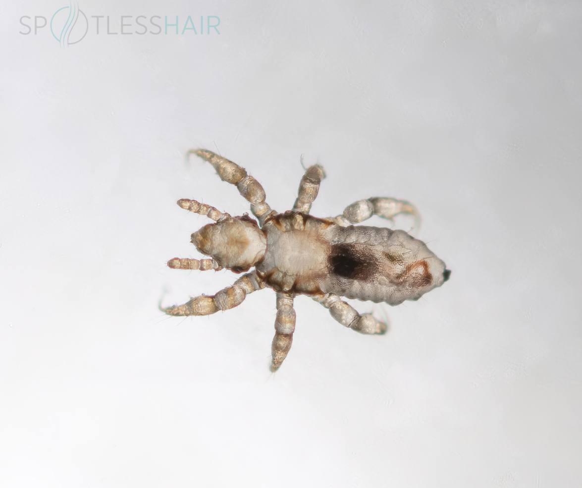 شكل الحورية القمل