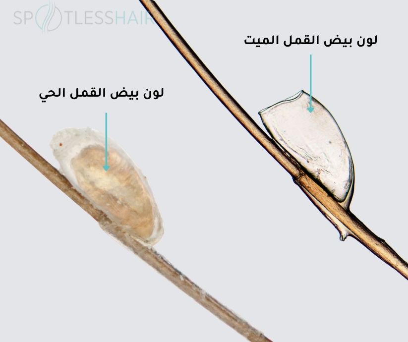 الفرق بين لون الصيبان الميت والحي