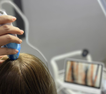 كيف أعرف أن القمل اختفى من شعري؟