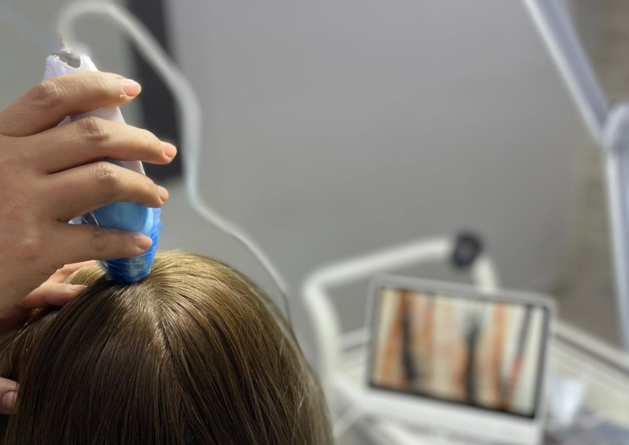 كيف أعرف أن القمل اختفى من شعري؟