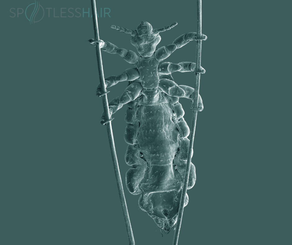 Credit: Kevin Mackenzie, University of Aberdeen  Source: Wellcome Collection (CC BY 4 0)